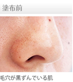 �V���L�[�J�o�[